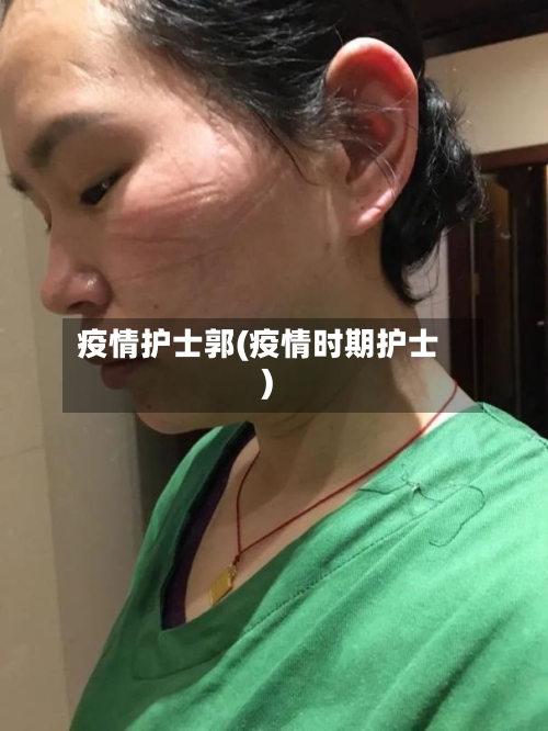 疫情护士郭(疫情时期护士)