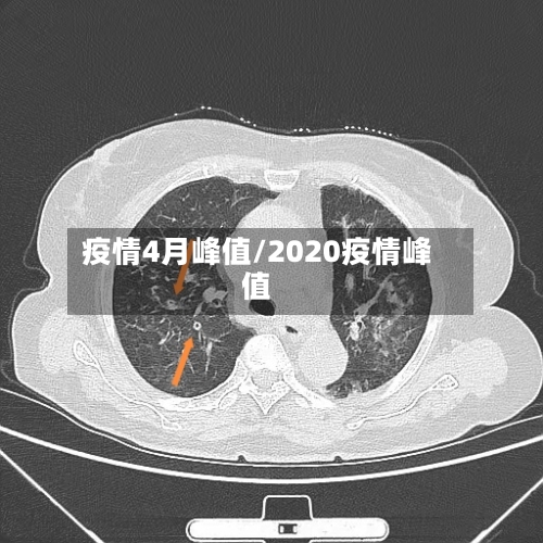疫情4月峰值/2020疫情峰值