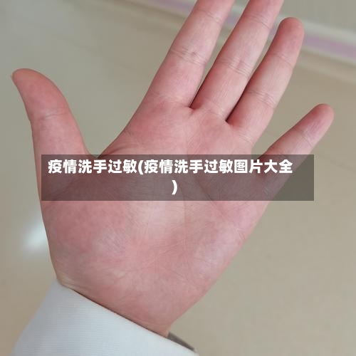 疫情洗手过敏(疫情洗手过敏图片大全)