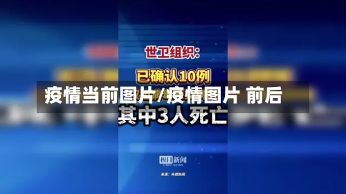 疫情当前图片/疫情图片 前后