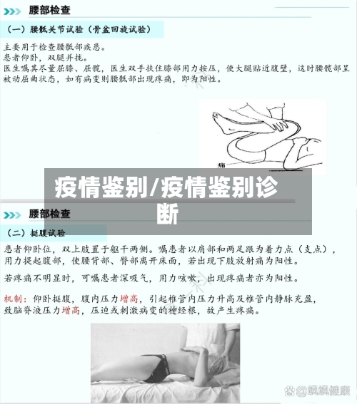 疫情鉴别/疫情鉴别诊断