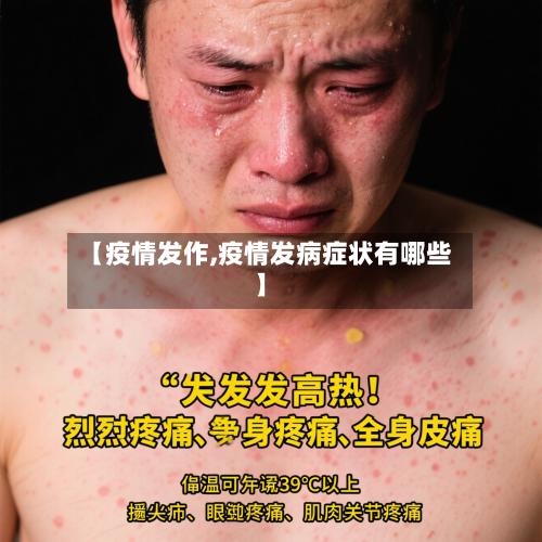 【疫情发作,疫情发病症状有哪些】