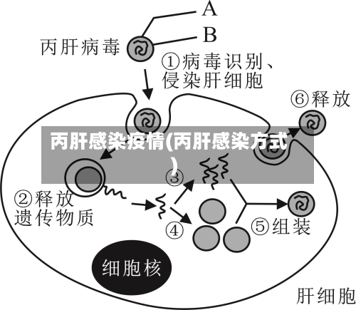丙肝感染疫情(丙肝感染方式)