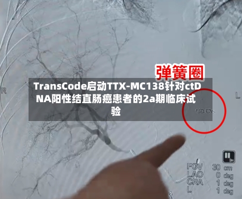 TransCode启动TTX-MC138针对ctDNA阳性结直肠癌患者的2a期临床试验
