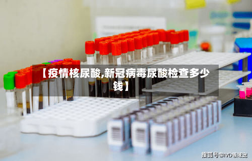 【疫情核尿酸,新冠病毒尿酸检查多少钱】
