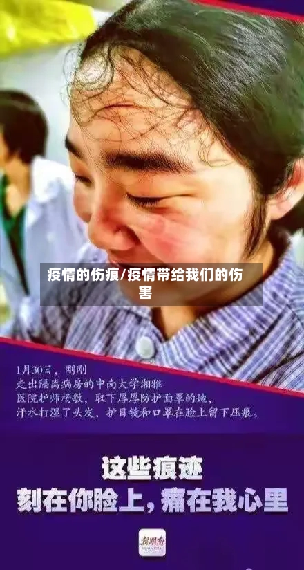 疫情的伤痕/疫情带给我们的伤害