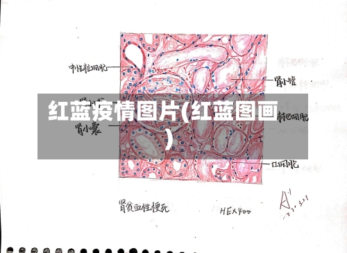 红蓝疫情图片(红蓝图画)
