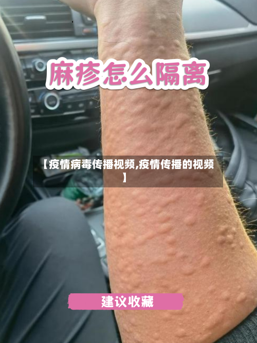 【疫情病毒传播视频,疫情传播的视频】