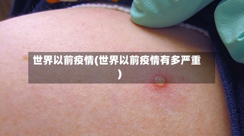 世界以前疫情(世界以前疫情有多严重)