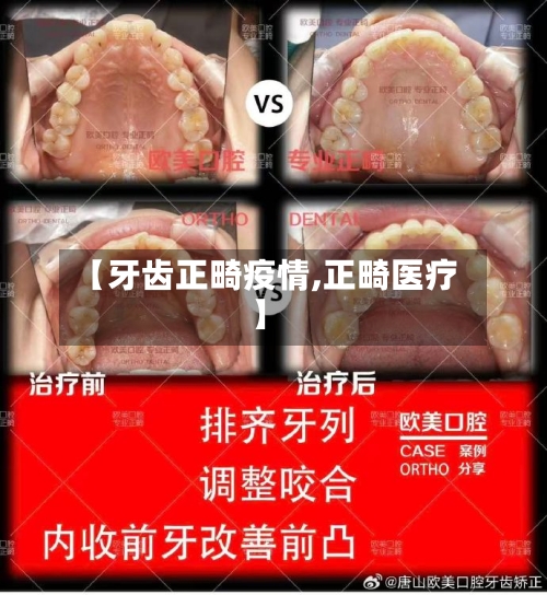【牙齿正畸疫情,正畸医疗】
