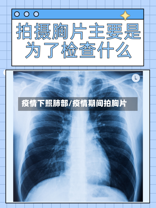 疫情下照肺部/疫情期间拍胸片