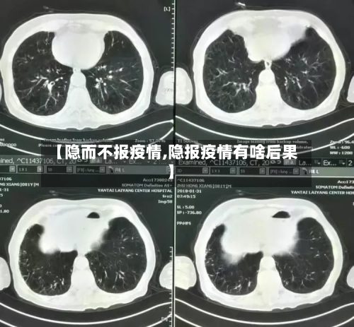【隐而不报疫情,隐报疫情有啥后果】