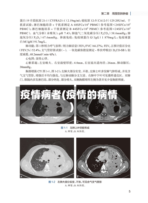 疫情病者(疫情的病情)