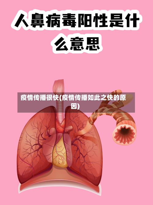 疫情传播很快(疫情传播如此之快的原因)