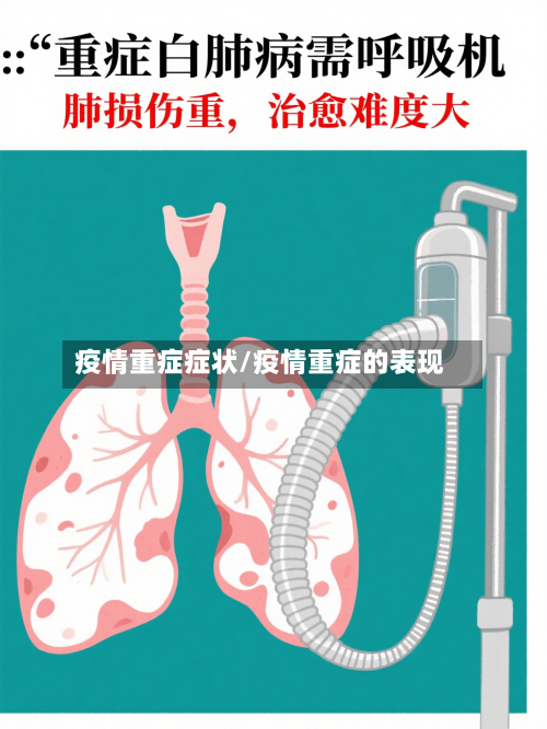 疫情重症症状/疫情重症的表现