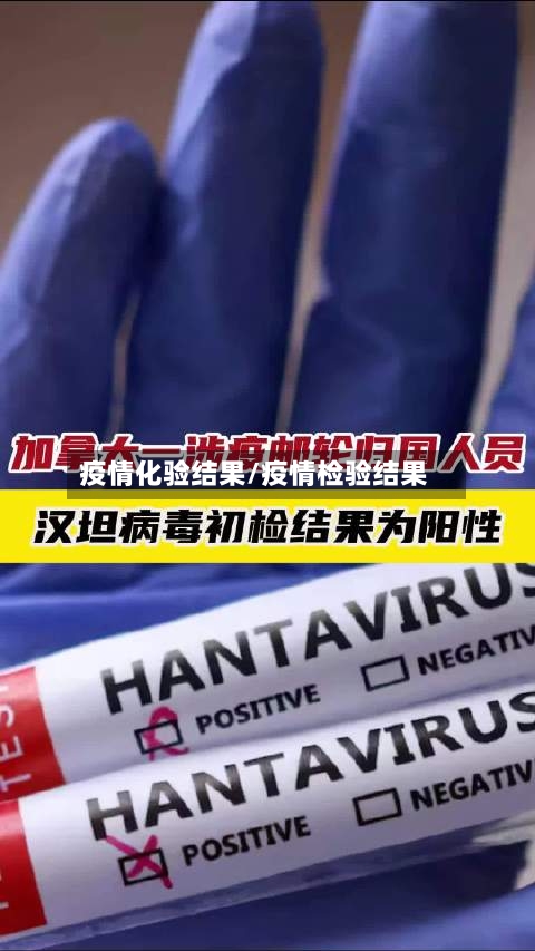 疫情化验结果/疫情检验结果
