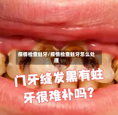 疫情检查蛀牙/疫情检查蛀牙怎么处理