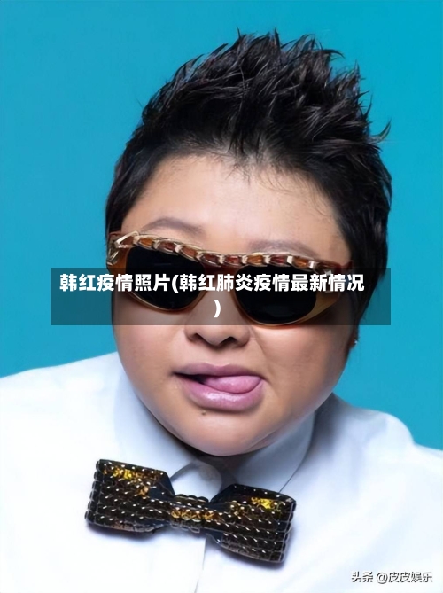 韩红疫情照片(韩红肺炎疫情最新情况)