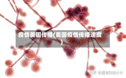 疫情美国传播(美国疫情传播速度)