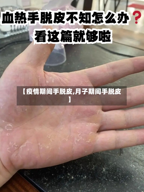 【疫情期间手脱皮,月子期间手脱皮】