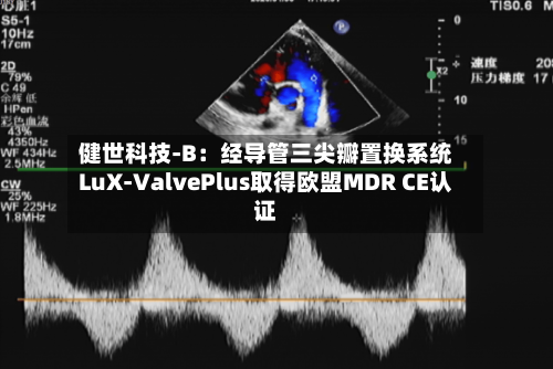 健世科技-B：经导管三尖瓣置换系统LuX-ValvePlus取得欧盟MDR CE认证