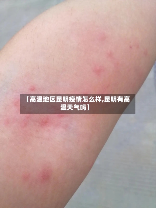 【高温地区昆明疫情怎么样,昆明有高温天气吗】