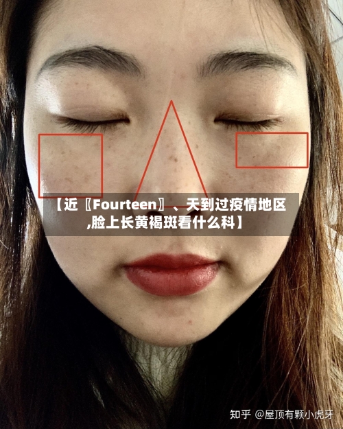 【近〖Fourteen〗、天到过疫情地区,脸上长黄褐斑看什么科】